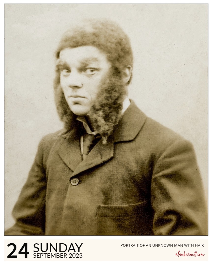 Portrait Of An Unknown Man With&nbsp;Hair